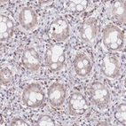 Immunohistochemical staining of human rectum shows moderate cytoplasmic/ nuclear positivity in lymphoid cells.