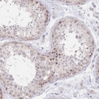 Immunohistochemical staining of human testis shows weak nuclear positivity in a small subset of cells in seminiferous ducts.