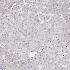 Immunohistochemical staining of human liver shows no positivity in hepatocytes as expected.