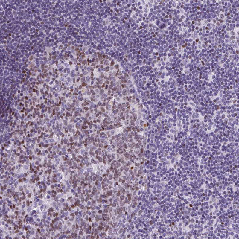 Anti-SPC24 Antibody
