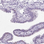 Immunohistochemical staining of human fallopian tube shows weak nuclear positivity in glandular cells.