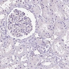 Immunohistochemical staining of human kidney shows negative nuclear positivity in cells in tubules and cells in glomeruli as expected.
