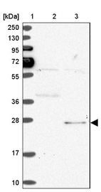 Lane 1: Marker [kDa] 250, 130, 95, 72, 55, 36, 28, 17, 10_br/_Lane 2: Human cell line RT-4_br/_Lane 3: Human cell line U-251MG sp