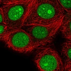Immunofluorescent staining of human cell line MCF7 shows localization to nucleus & nucleoli.