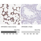 Anti-ARHGDIB Antibody