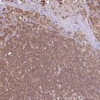 Immunohistochemical staining of human tonsil shows moderate cytoplasmic positivity in non-germinal center cells.