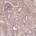 Immunohistochemical staining of human kidney shows weak to moderate membranous and cytoplasmic positivity in cells in tubules.