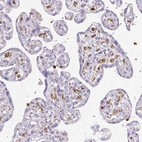 Immunohistochemical staining of human placenta shows strong cytoplasmic positivity in Hofbauer cells.