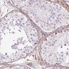 Immunohistochemical staining of human testis shows weak to moderate positivity in peritubular myoid cells.