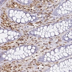 Immunohistochemical staining of human colon shows strong cytoplasmic and nuclear positivity in lymphoid cells.