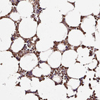 Immunohistochemical staining of human bone marrow shows strong cytoplasmic and nuclear positivity in hematopoietic cells.