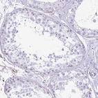 Immunohistochemical staining of human testis shows negative cytoplasmic positivity in cells in seminiferous ducts as expected.