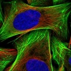 Immunofluorescent staining of human cell line U-2 OS shows localization to cytosol & actin filaments.