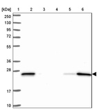 Lane 1: Marker [kDa] 250, 130, 95, 72, 55, 36, 28, 17, 10_br/_Lane 2: Human cell line RT-4_br/_Lane 3: Human cell line U-251MG sp_br/_Lane 4: Human plasma (IgG/HSA depleted)_br/_Lane 5: Human liver tissue_br/_Lane 6: Human tonsil tissue