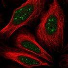 Immunofluorescent staining of human cell line U-2 OS shows localization to nucleus & nucleoli.