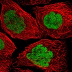 Immunofluorescent staining of human cell line A-431 shows localization to nucleoplasm.