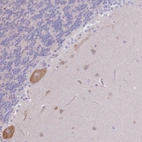 Immunohistochemical staining of human cerebellum shows moderate cytoplasmic and membranous positivity in Purkinje cells.
