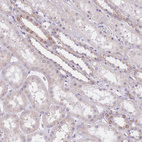 Immunohistochemical staining of human kidney shows weak cytoplasmic and membranous positivity in cells in tubules.