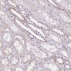 Immunohistochemical staining of human kidney shows weak cytoplasmic and membranous positivity in cells in tubules.