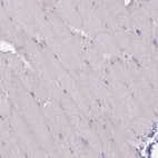 Immunohistochemical staining of human skeletal muscle shows no positivity in myocytes as expected.