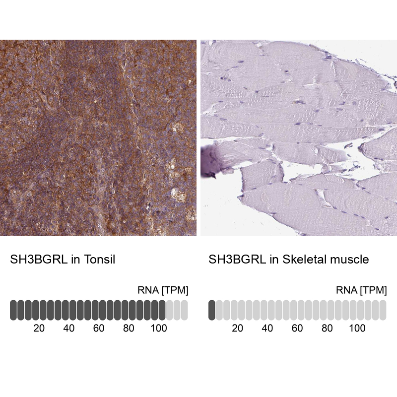 Anti-SH3BGRL Antibody