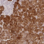 Anti-MBD3L3 Antibody