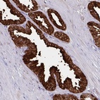 Anti-MSMB Antibody