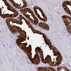 Immunohistochemical staining of human prostate shows high expression.