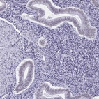 Immunohistochemical staining of human endometrium shows low expression as expected.