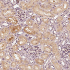 Anti-SLC34A1 Antibody