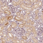 Anti-SLC34A1 Antibody