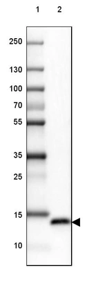 Lane 1: Marker [kDa] 250, 130, 100, 70, 55, 35, 25, 15, 10_br/_Lane 2: Human Prostate tissue