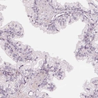 Immunohistochemical staining of human prostate shows no positivity in glandular cells as expected.