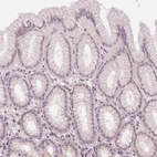 Immunohistochemical staining of human stomach shows no positivity in glandular cells as expected.