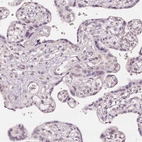 Immunohistochemical staining of human placenta shows no positivity in trophoblastic cells as expected.