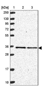 Lane 1: Marker [kDa] 250, 130, 95, 72, 55, 36, 28, 17, 10_br/_Lane 2: Human cell line RT-4_br/_Lane 3: Human cell line U-251MG sp