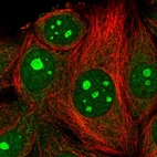 Immunofluorescent staining of human cell line MCF7 shows localization to nucleus, nucleoli, cytosol & endoplasmic reticulum.