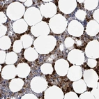 Immunohistochemical staining of human bone marrow shows positivity in hematopoietic cells.
