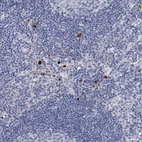 Immunohistochemical staining of human lymph node shows positivity in lymphoid cells.