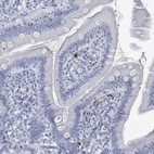 Immunohistochemical staining of human duodenum shows positivity in lymphoid cells.