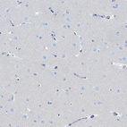 Anti-DEFA4 Antibody