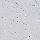 Immunohistochemical staining of human cerebral cortex shows no positivity as expected.