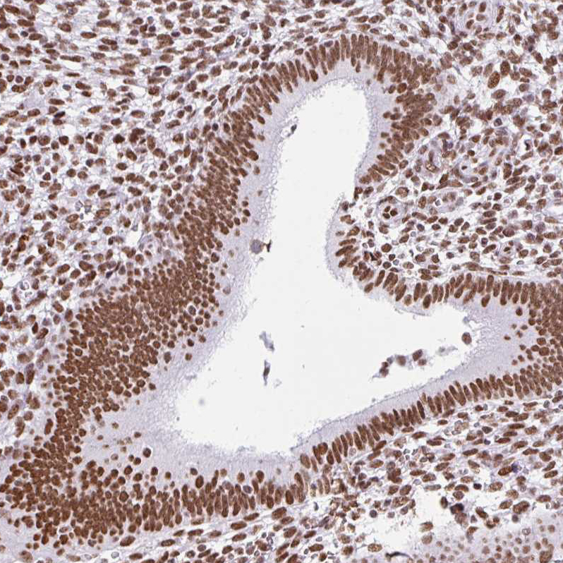 Anti-KHDRBS1 Antibody