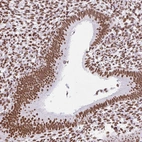 Anti-KHDRBS1 Antibody