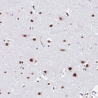 Immunohistochemical staining of human cerebral cortex shows strong nuclear positivity in neurons.