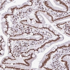 Immunohistochemical staining of human duodenum shows strong nuclear positivity in glandular cells.