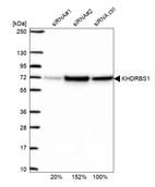 Western blot analysis in U2OS cells transfected with control siRNA, target specific siRNA probe #1 and #2, using Anti-KHDRBS1 antibody. Remaining relative intensity is presented.
