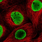 Immunofluorescent staining of human cell line A-431 shows localization to nucleoplasm.
