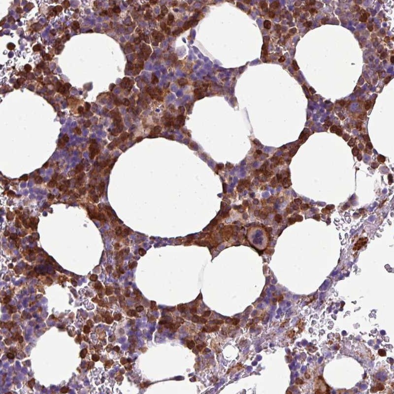Anti-TMEM8A Antibody