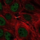 Immunofluorescent staining of human cell line MCF7 shows localization to nucleoplasm & cytokinetic bridge.